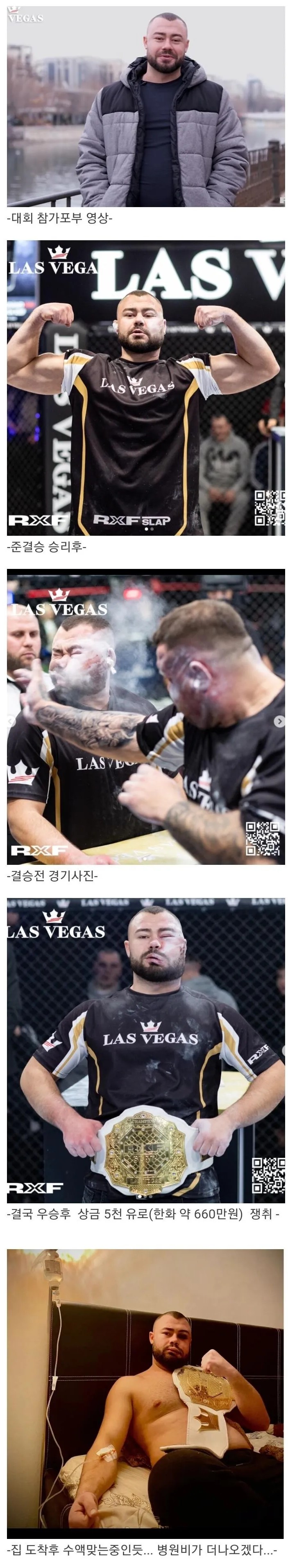 뺨때리기 대회 우승남.jpg