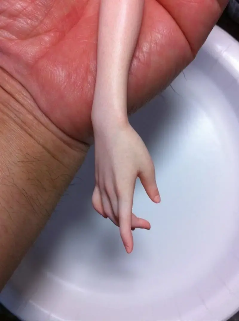 []
